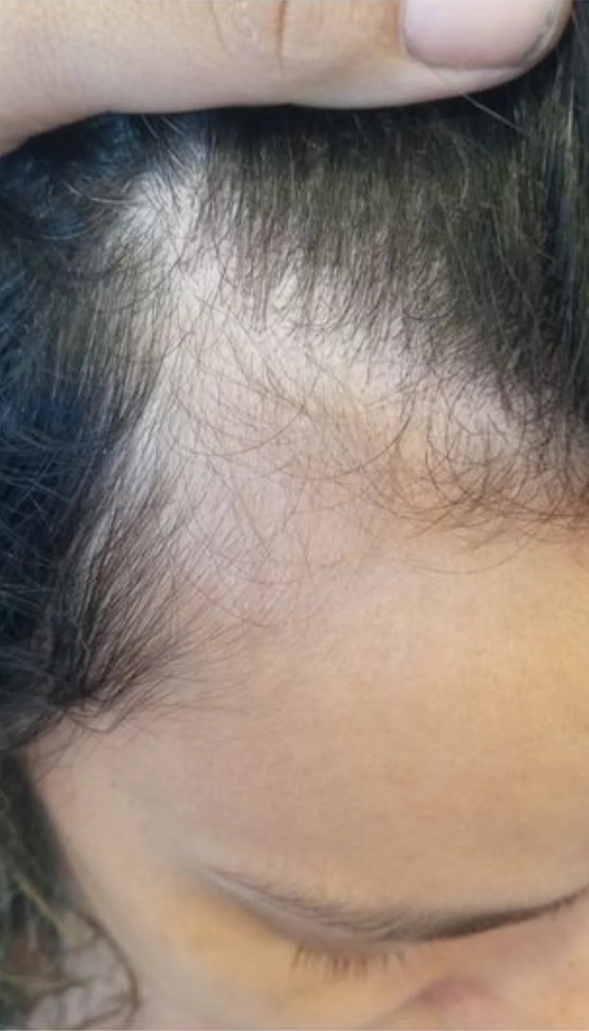 Before